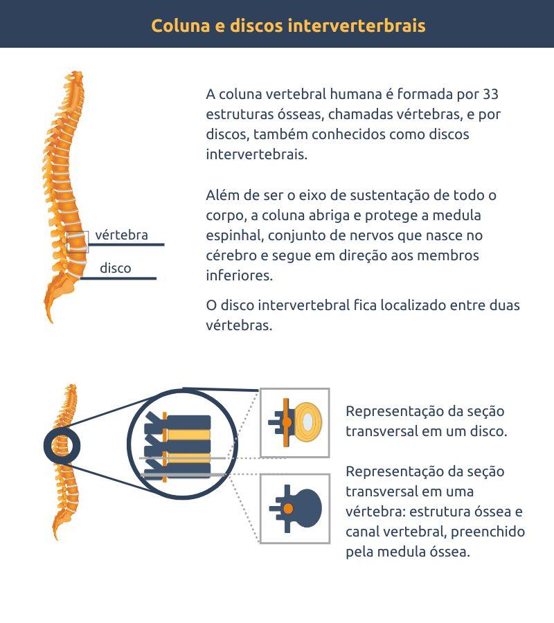 coluna e discos intervertebrais