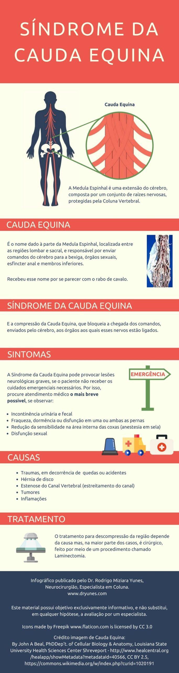 sindrome da cauda equina infografico