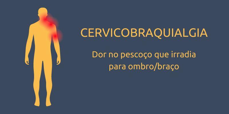 cervicobraquialgia img